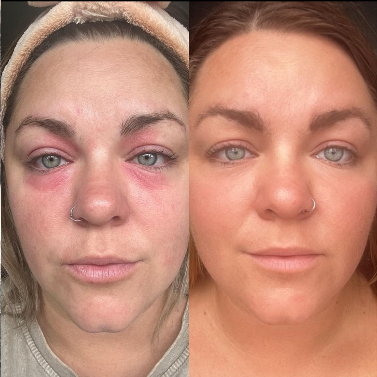 Multi-Use Skin Balm