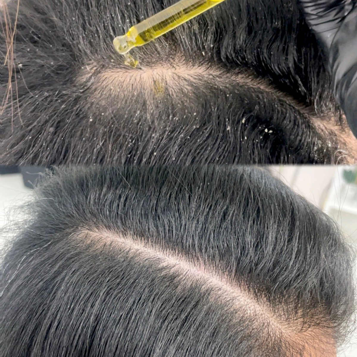 Serenity HHWB scalp, hair, skin oil